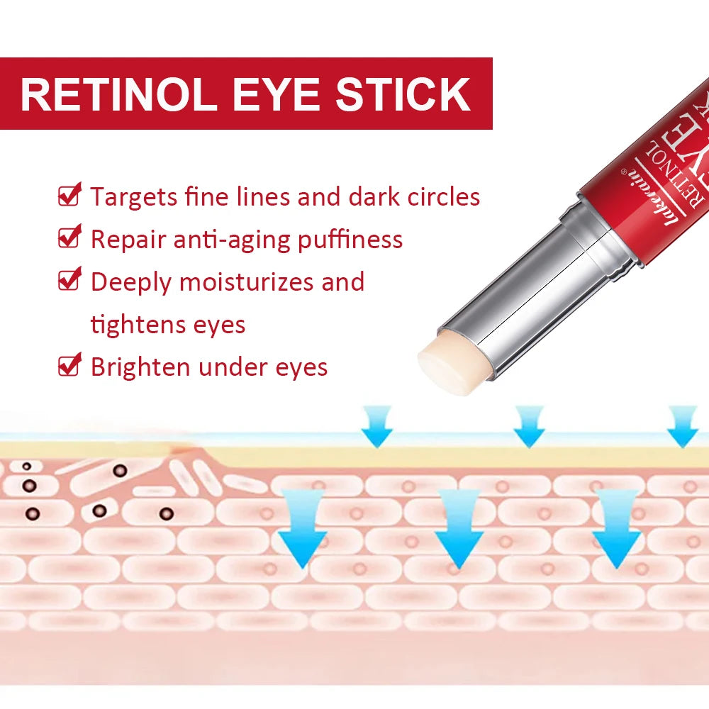 Retinol Eye Cream Lightening Dark Circles