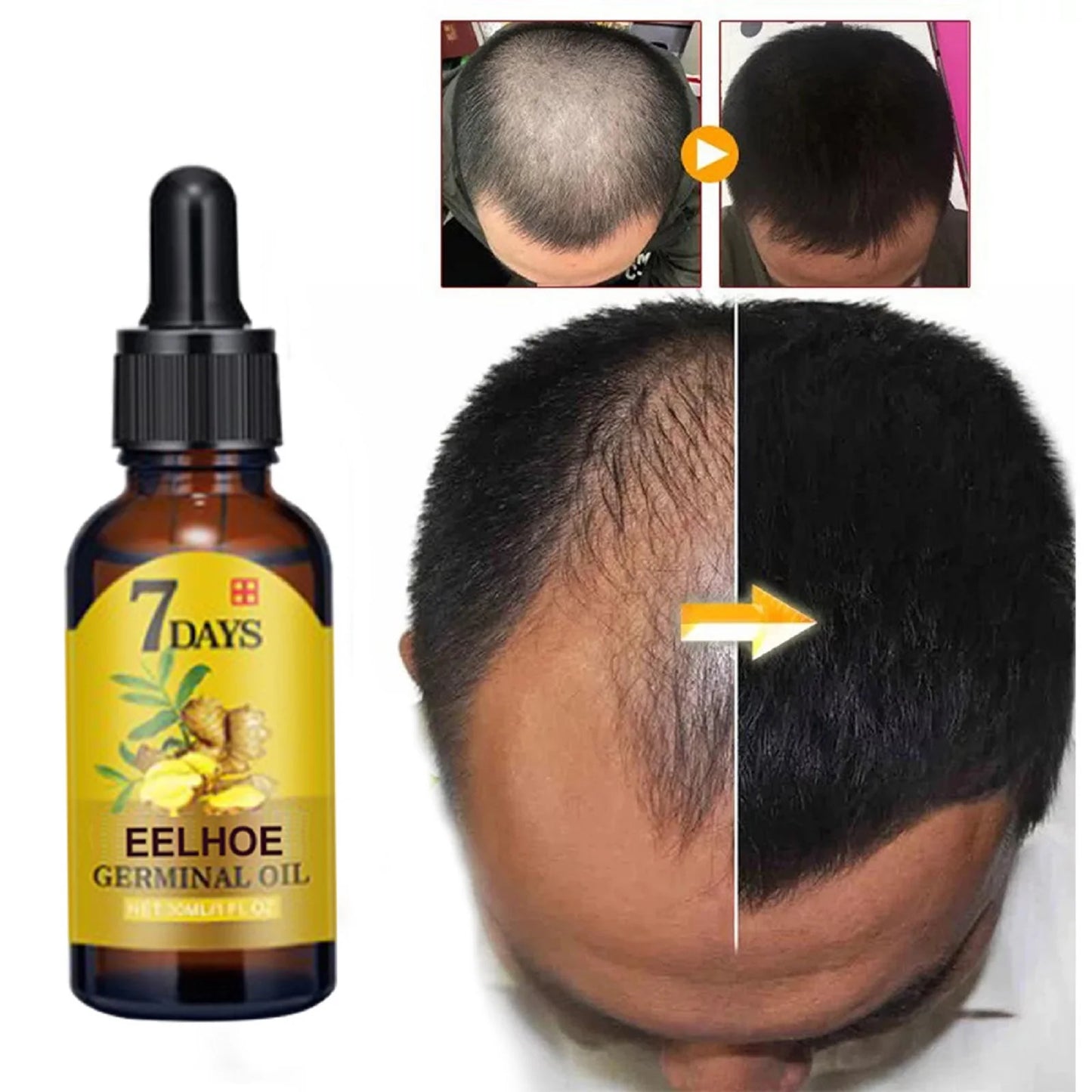 Ginger Hair Care Oil Roots Scalp Treatment