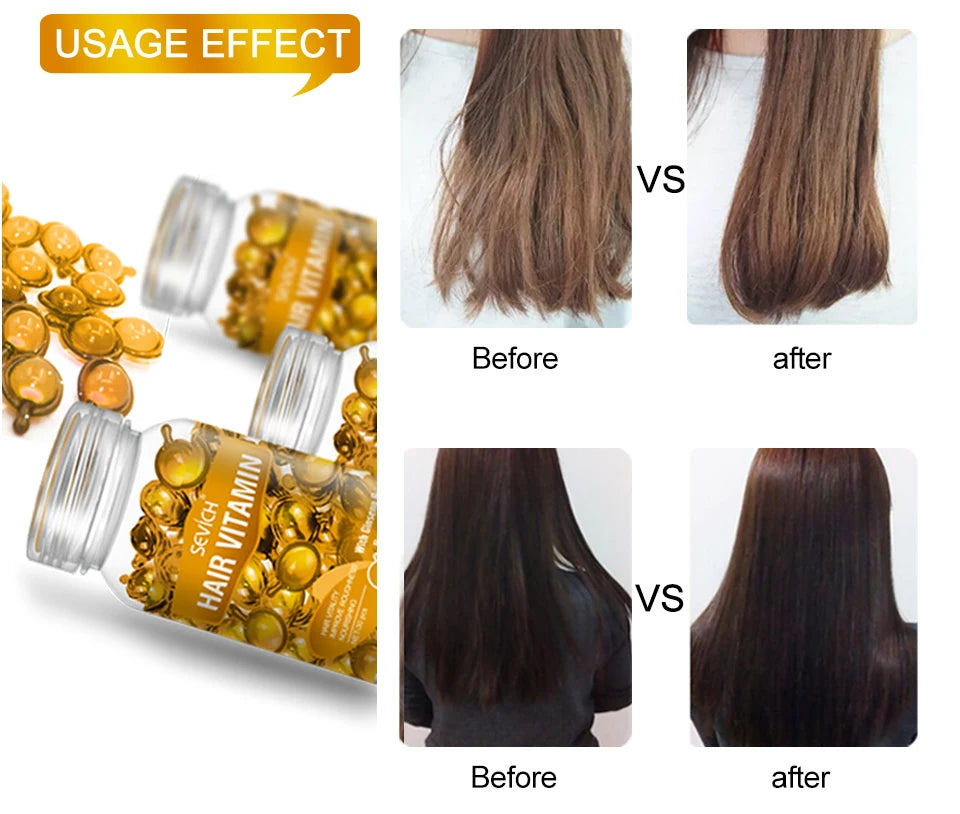 30 Capsules Anti Hair Loss Hair Vitamin
