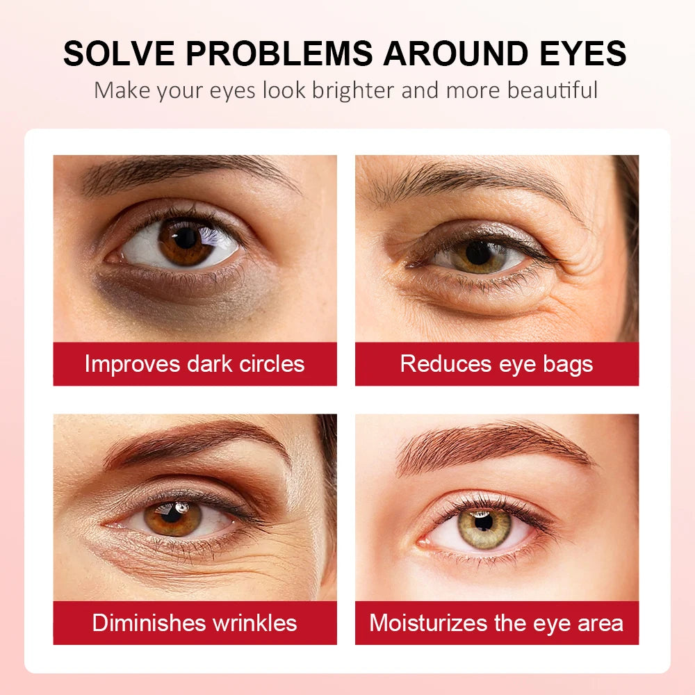 Retinol Eye Cream Lightening Dark Circles