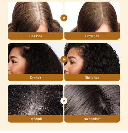 Lewedo Naturals Batana Oil Fast Hair Growth