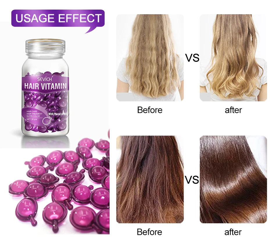 30 Capsules Anti Hair Loss Hair Vitamin