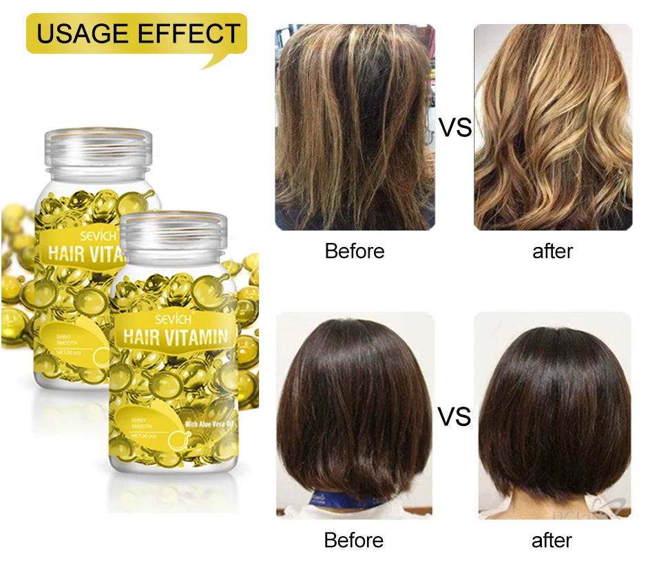 30 Capsules Anti Hair Loss Hair Vitamin