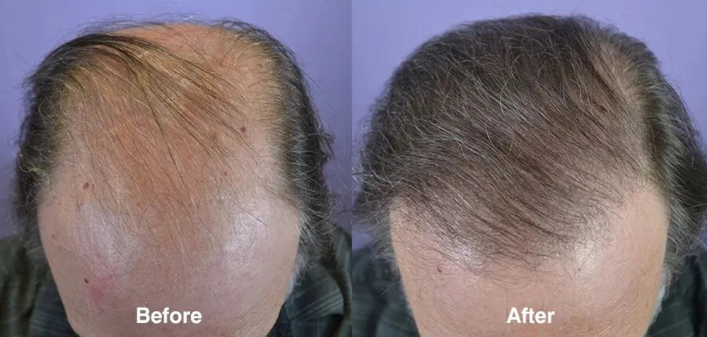 Ginger Hair Care Oil Roots Scalp Treatment