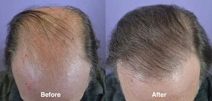 Ginger Hair Care Oil Roots Scalp Treatment