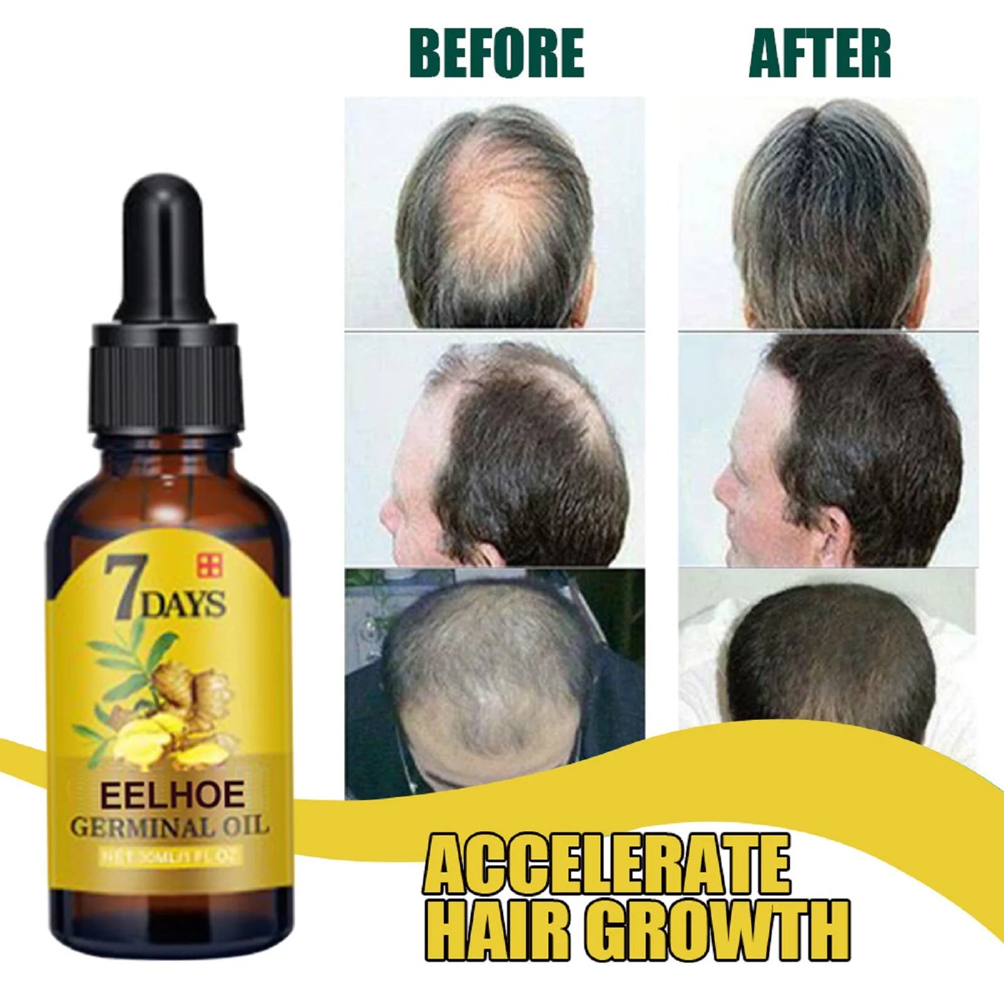 Ginger Hair Care Oil Roots Scalp Treatment
