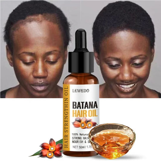 Lewedo Naturals Batana Oil Fast Hair Growth