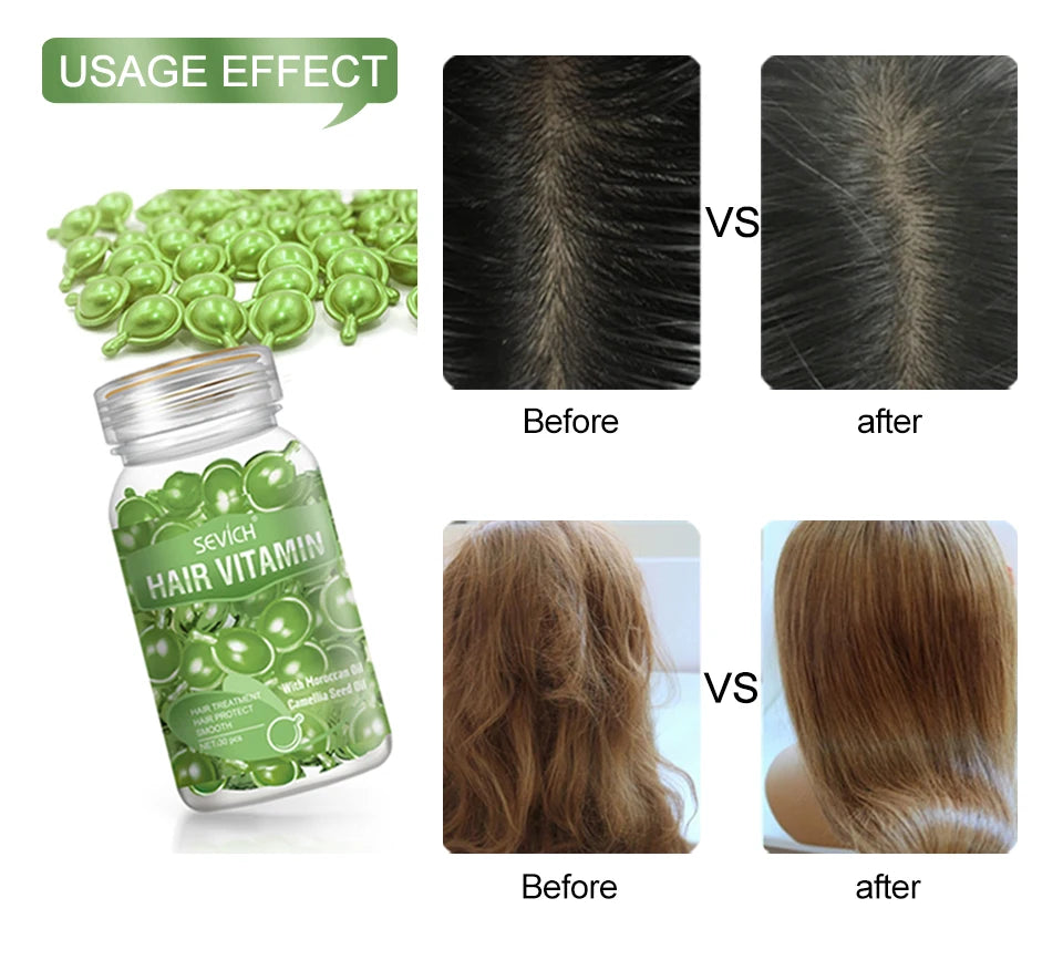 30 Capsules Anti Hair Loss Hair Vitamin