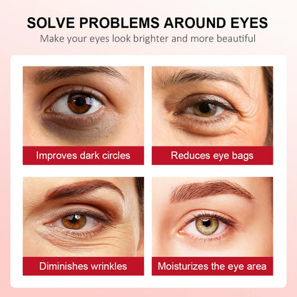 Retinol Eye Cream Lightening Dark Circles