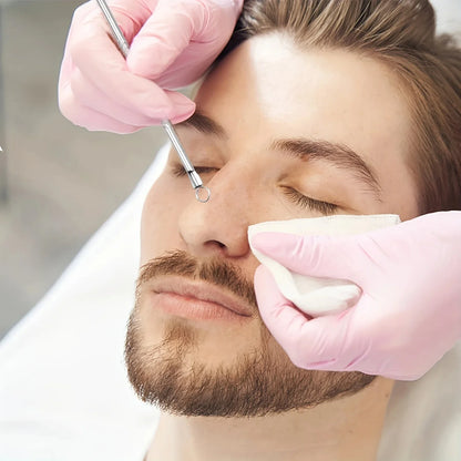 Ultra-Precise Tweezers Acne kit