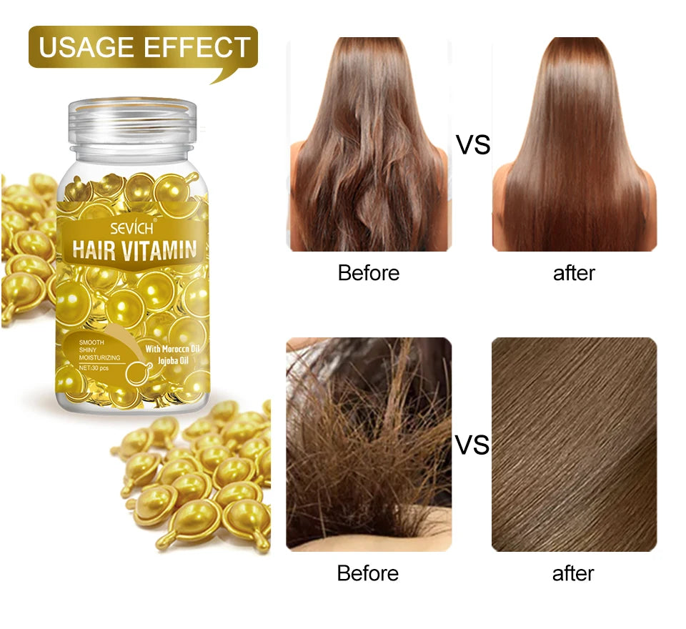 30 Capsules Anti Hair Loss Hair Vitamin