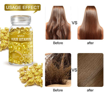 30 Capsules Anti Hair Loss Hair Vitamin