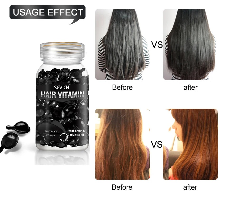 30 Capsules Anti Hair Loss Hair Vitamin